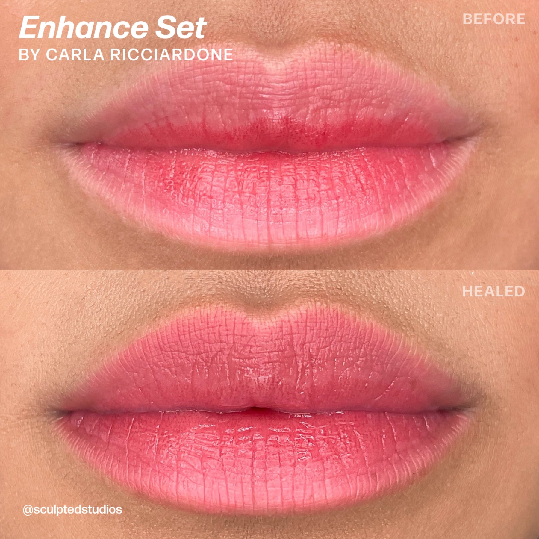 Perma Blend LUXE Carla Ricciardone Enhance Set