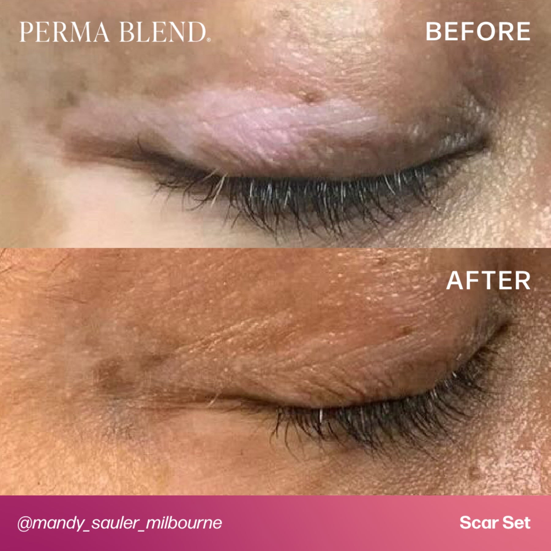 Perma Blend Scar Pigment Set