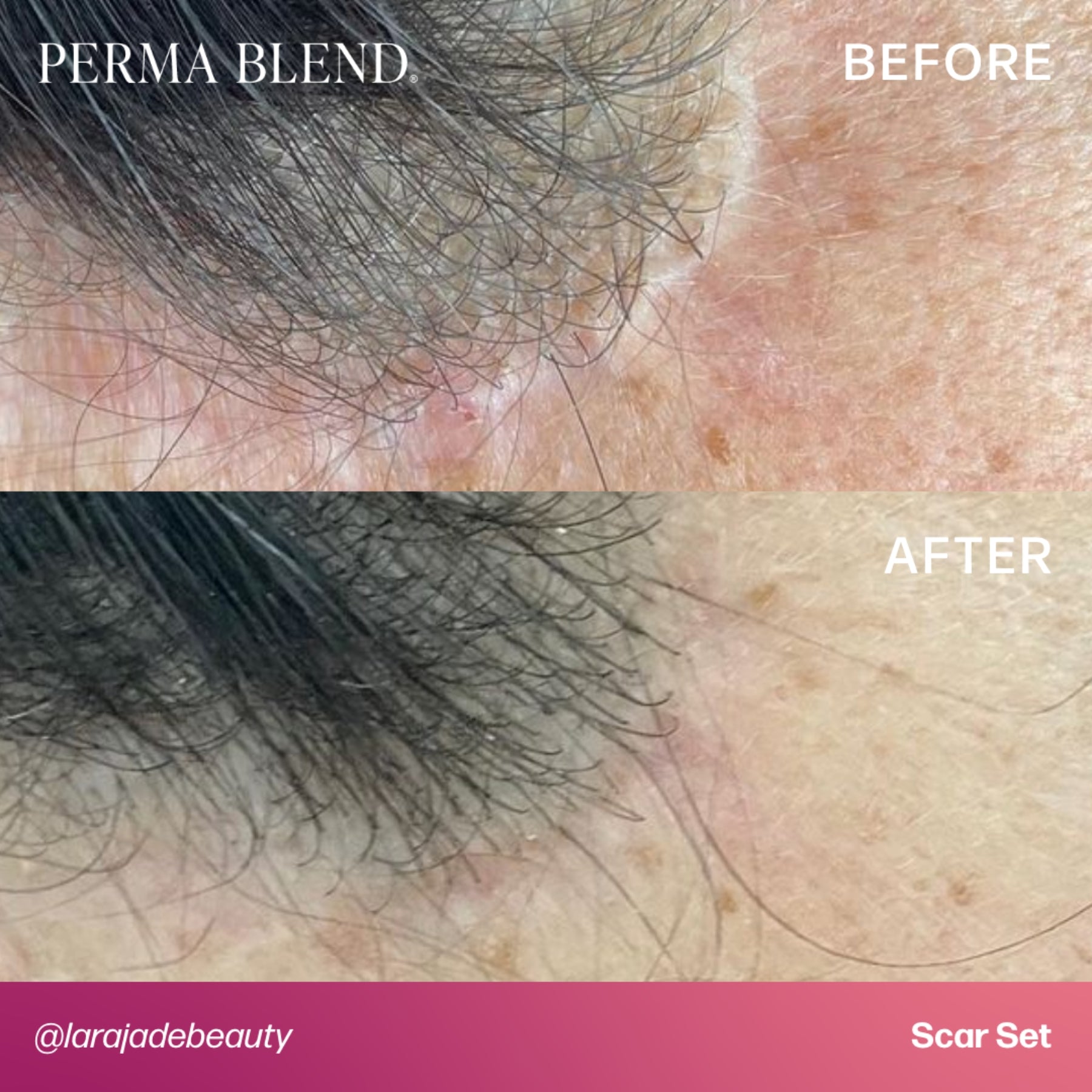 Perma Blend Scar Pigment Set