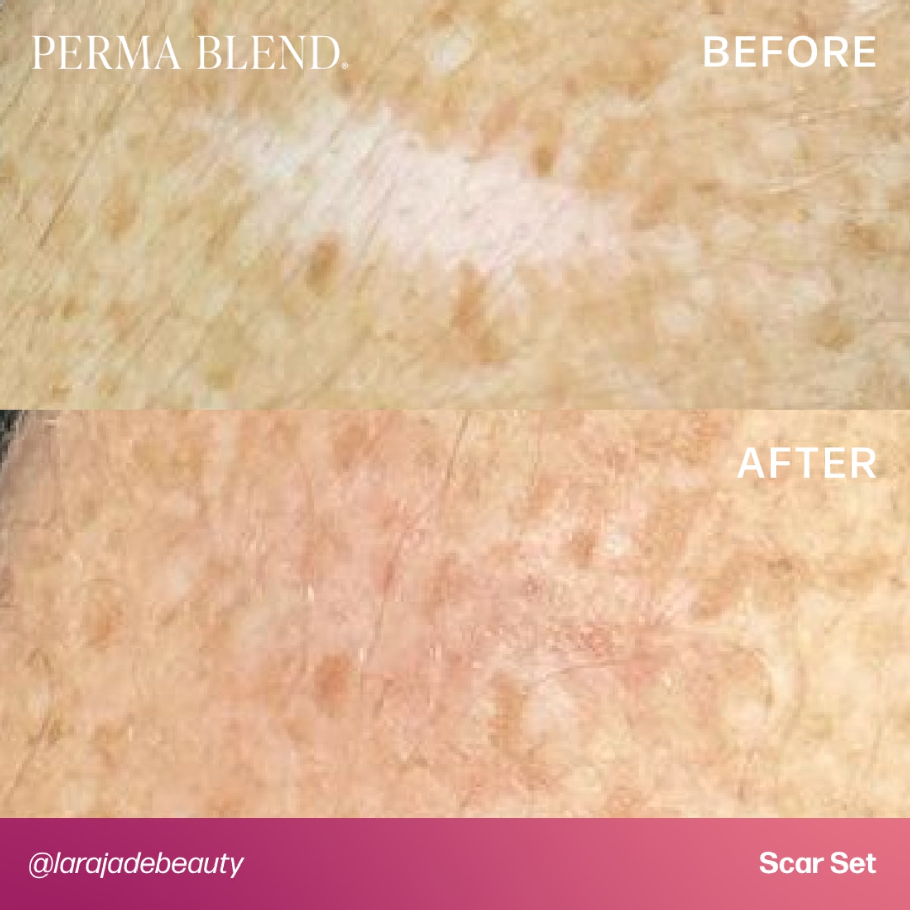 Perma Blend Scar Pigment Set