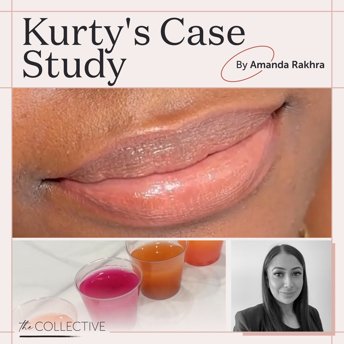 Fitz 6 Dark Lip Neutralization: Expert PMU Training with Amanda Rakhra