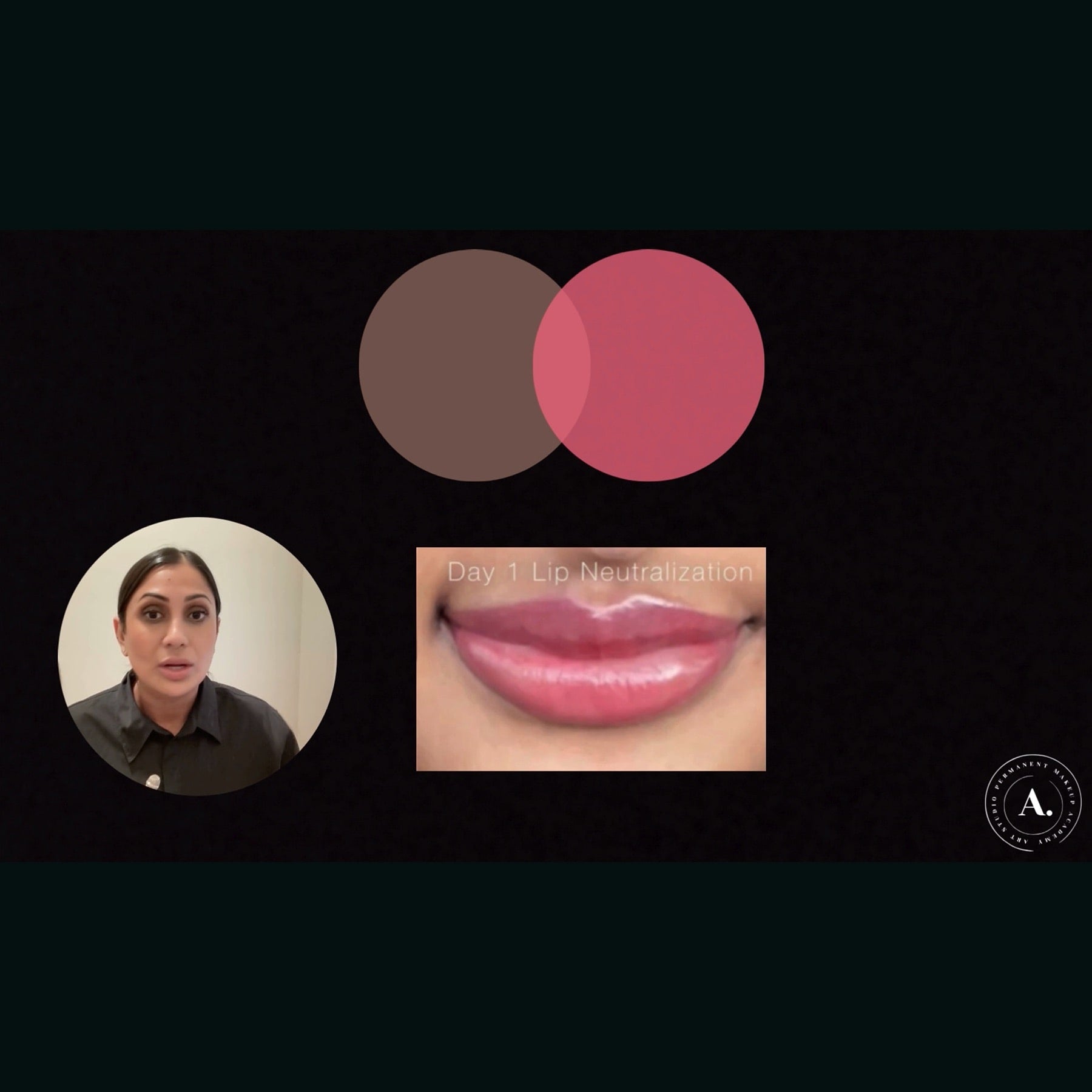 Fitz 5 Dark Lip Neutralization: Anita's Case Study by Amanda Rakhra