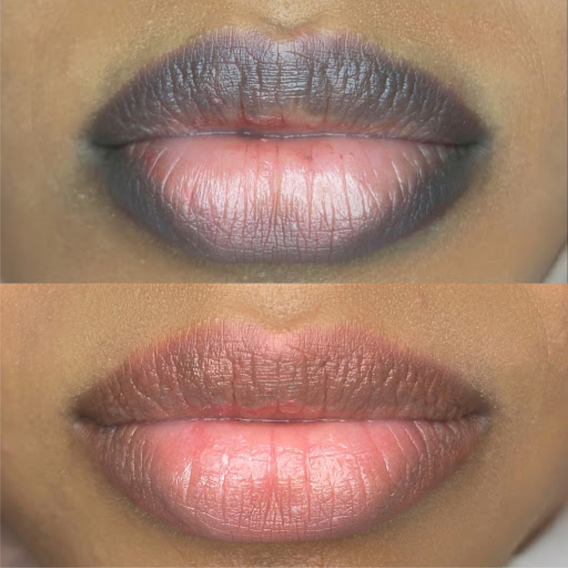 Lip Magic: Dark Lip Neutralization