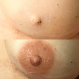 3D Areola Tattooing